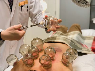 Promise Integrative Medicine Clinic - Cupping Theraphy