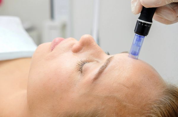 Microneedling Treatment