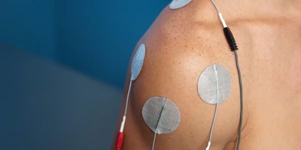 Neuro Physio Hitchin Electrical Stimulation