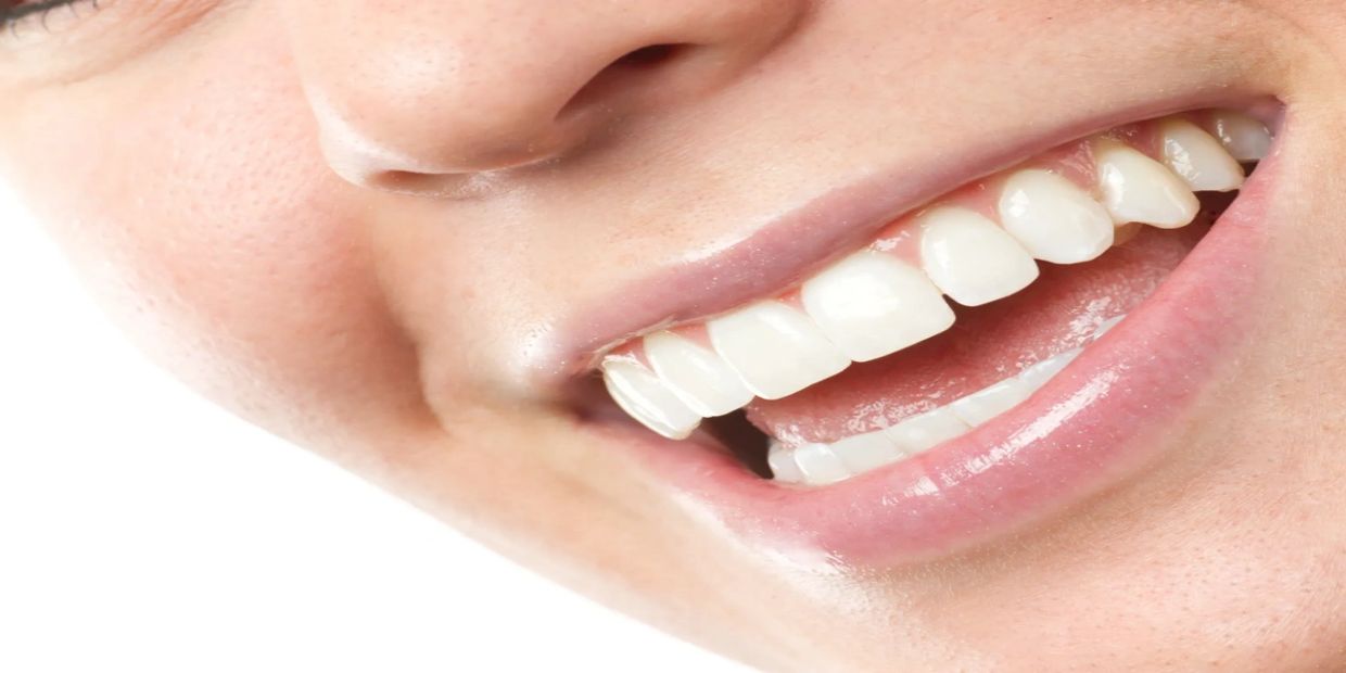 Close-up of a smiling mouth showing white teeth.