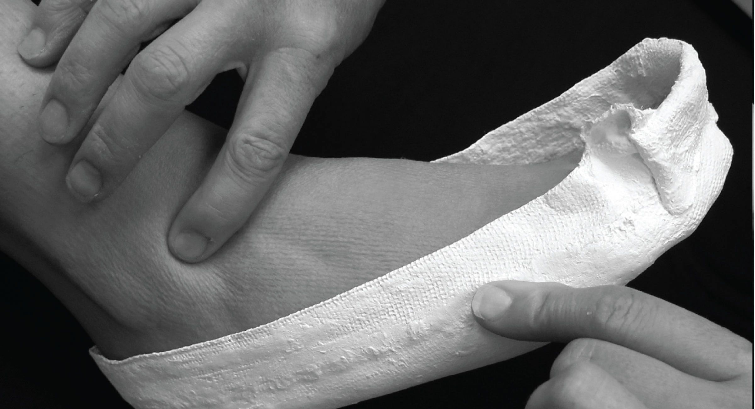 hands doing a plaster cast of a foot