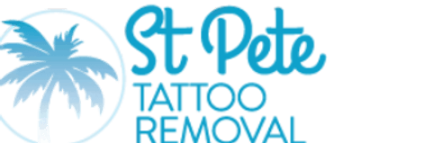 St.petetattoo removal