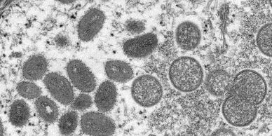 Photo from CDC