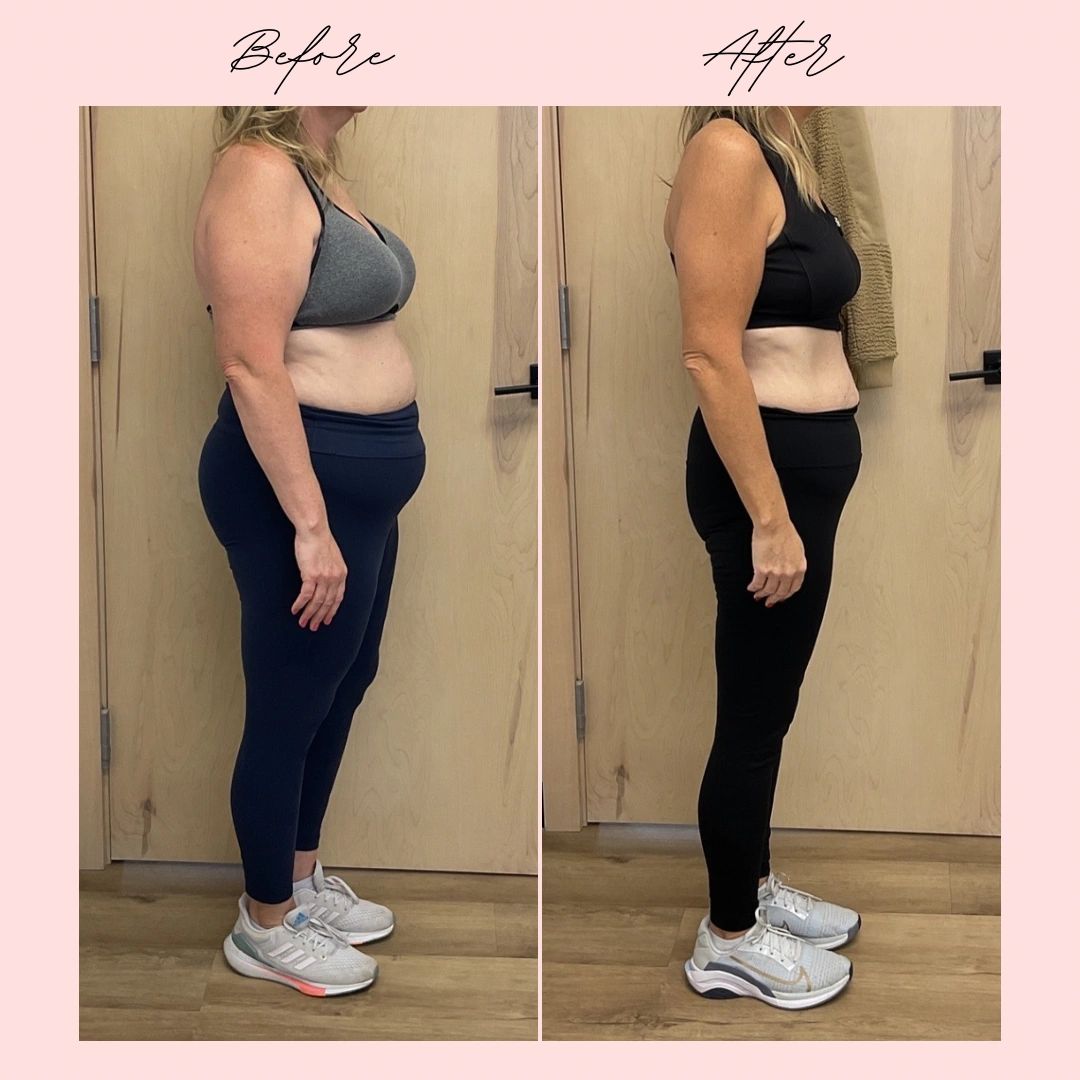 elara glp-1 reviews GLP-1 Program
