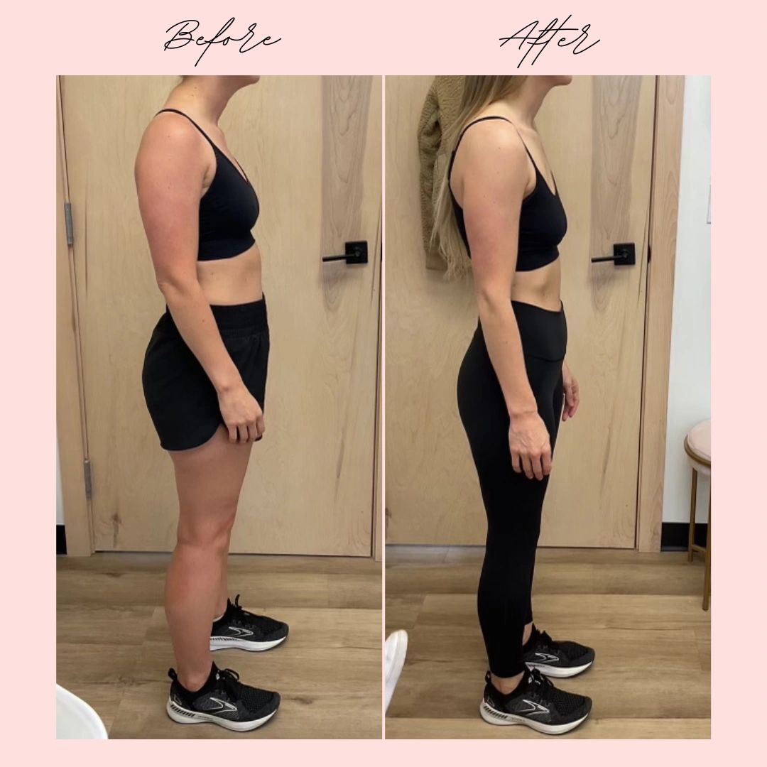 glp-1 omaha ne GLP-1 Program