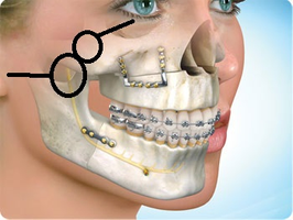 Dr Eswars Facio Dental Clinics -OMFS