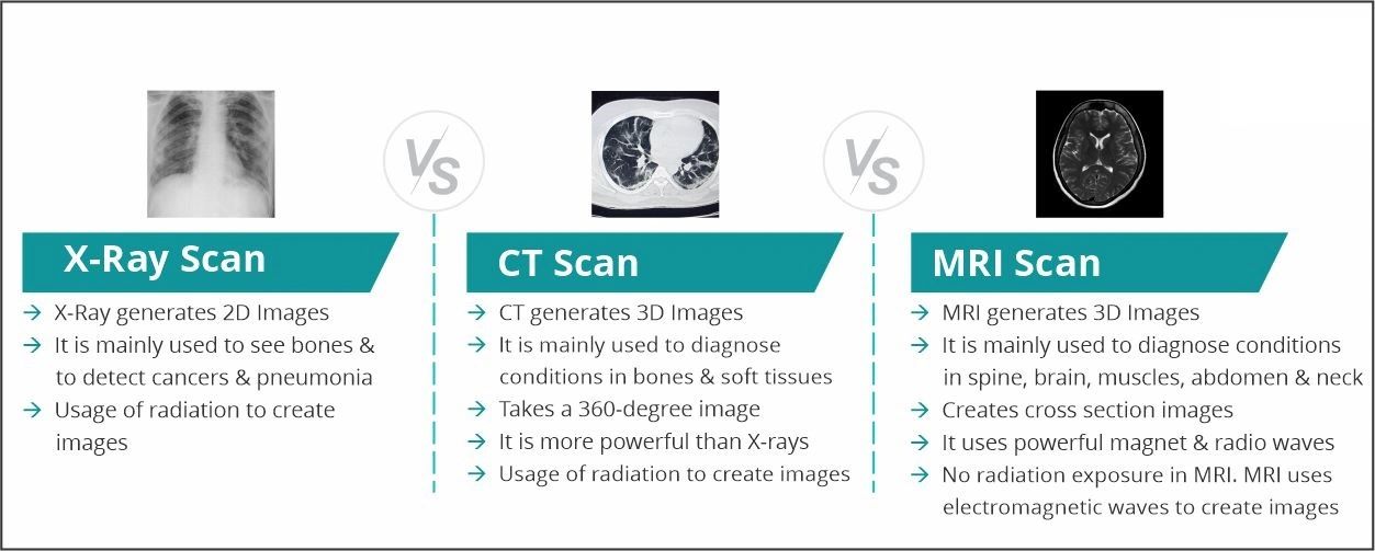 X-Ray vs. CT vs. MRI