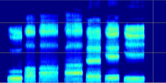 Voice resonance overtones power spectrum