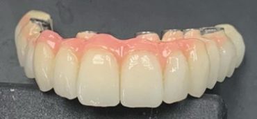 A set of dental prosthetic teeth with pink gums.