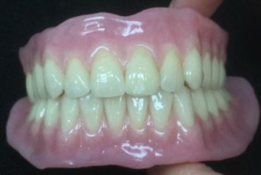 A pair of artificial dentures with pink gums and white teeth.
