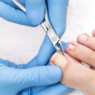 Podiatrist performing nail surgery