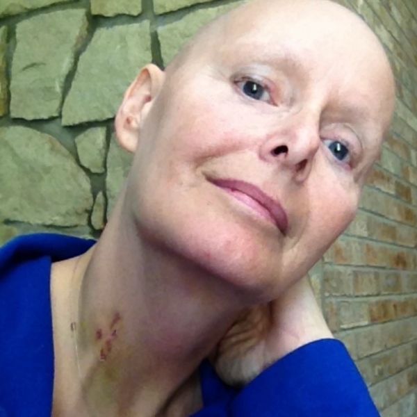 I have been through treatment…just like you.