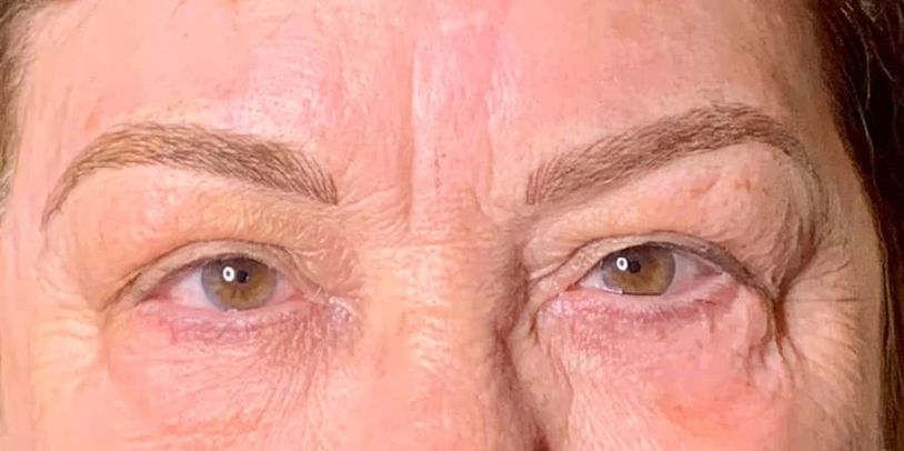 Microblading on older skin