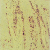 Psoria-Gold Phosphorylase Kinase
