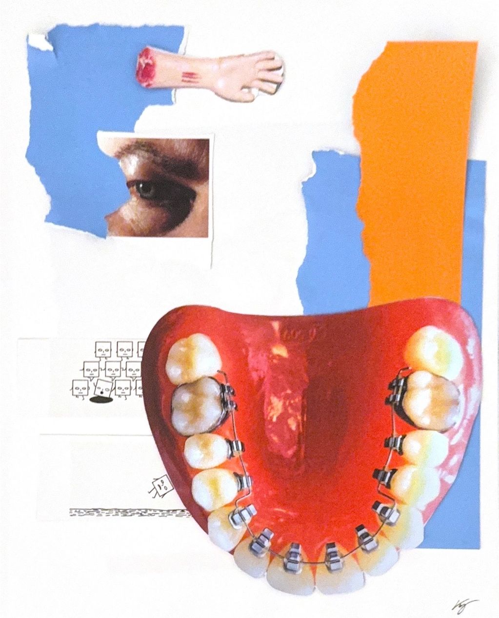 Surreal collage featuring braces, an eye, a dismembered hand, and abstract shapes.