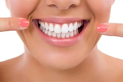 Teeth Whitening at Malibu Teeth Whitening, Inc.