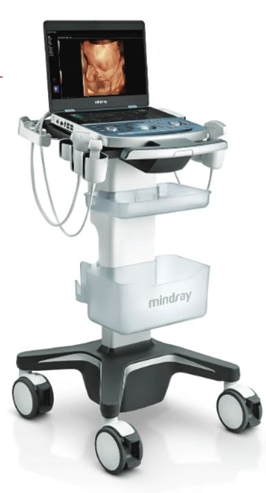 Mindray ultrasound machine displaying a 3D fetal image.