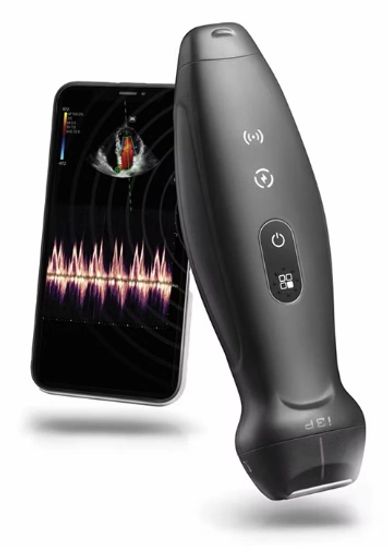 Wireless handheld ultrasound device paired with a smartphone for real-time imaging.