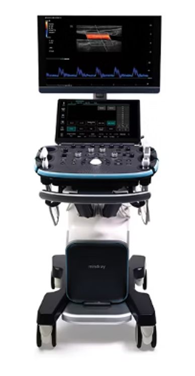 Advanced medical ultrasound machine with dual monitors and control panel.
