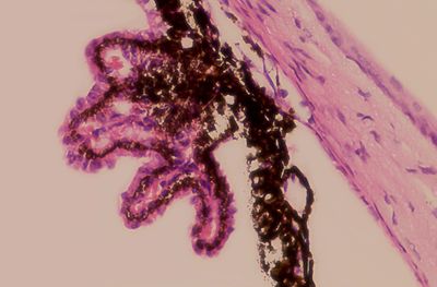 Ciliary Body H&E section