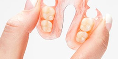 Valplast partial from  best dental laboratory in San Dimas CA