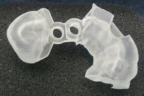 3D printed Surgical guides from creative image dental laboratory best dental laboratory in CA