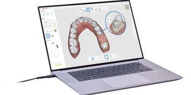  Send us your  Medit files  and get your crown in 3 days in lab tunr around time, 