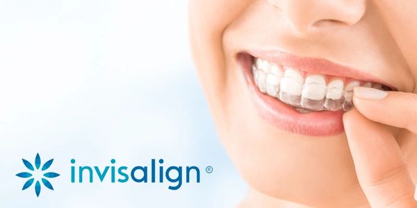 Invisalign or Braces by dentist in Aurora or Newmarket