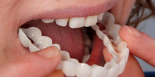 Person placing a dental mold or teeth whitening tray in their mouth.