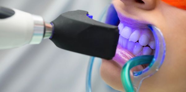 Close-up of teeth whitening procedure using UV light.