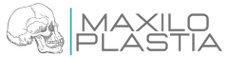 Maxiloplastia