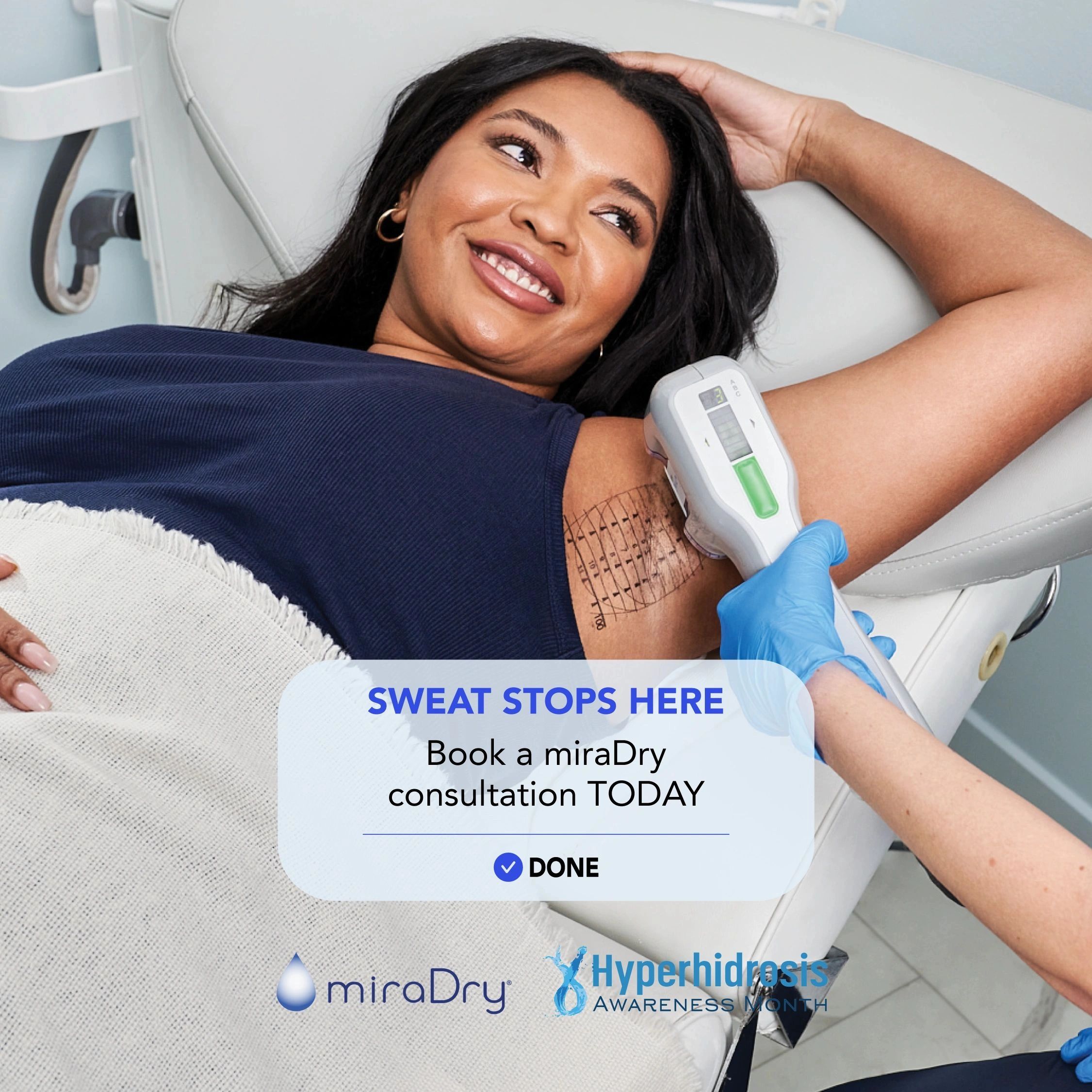 miradry india, miradry, hyperhidrosis treatment, bromhidrosis, underarm sweating, botox