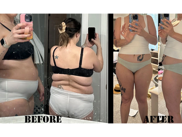 weight loss injections, weight loss program, skinny shot