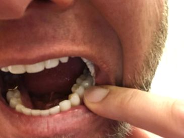Emergency Dentist Rainier St Helens Astoria
