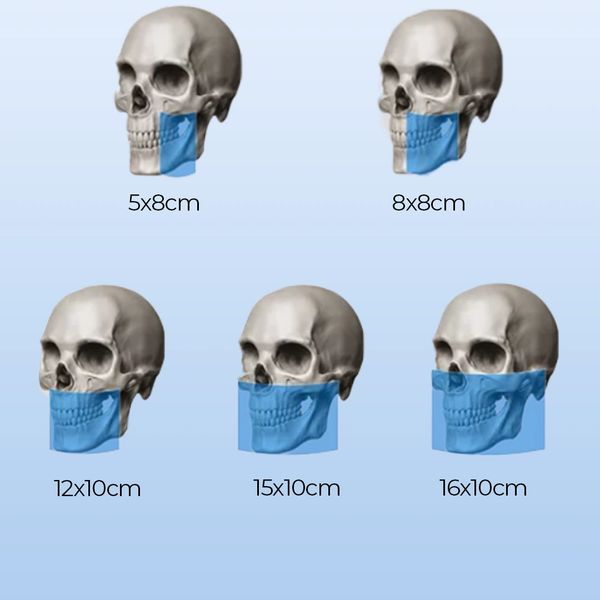 LargeV Smart3D-X Dental Tomografi