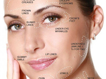 Woman's face with cosmetic concern areas marked for treatment.