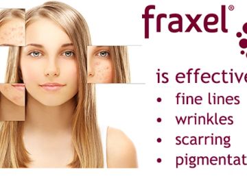 Fraxel treatment improves skin by reducing fine lines, wrinkles, scarring, and pigmentation.