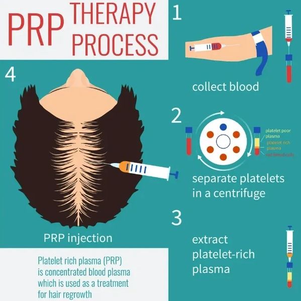 PRP therapy for men and women