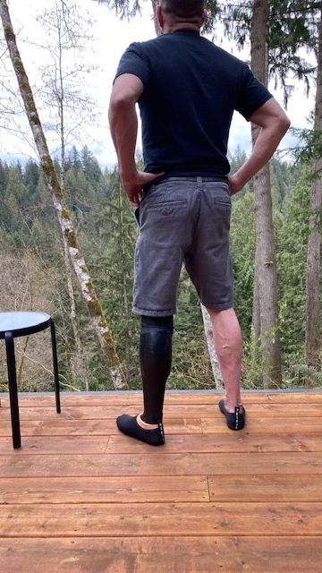 My Leg by Design