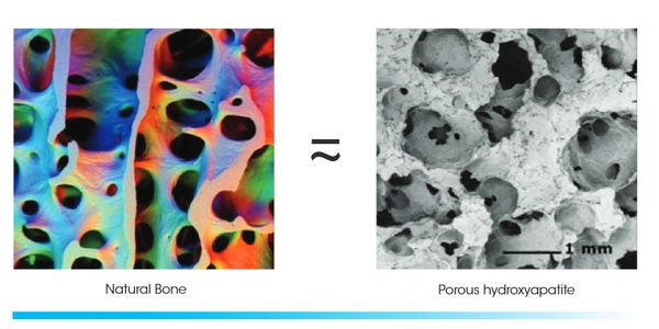 Comparison of natural bone and porous hydroxyapatite structures.