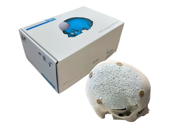 Medical cranial implant model with packaging box.