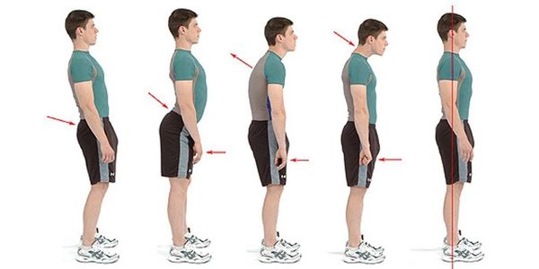 Illustration showing different types of posture from poor to good.