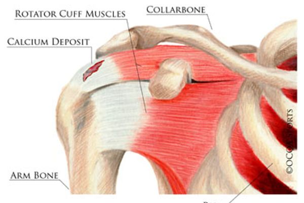 Rotator Cuff Image