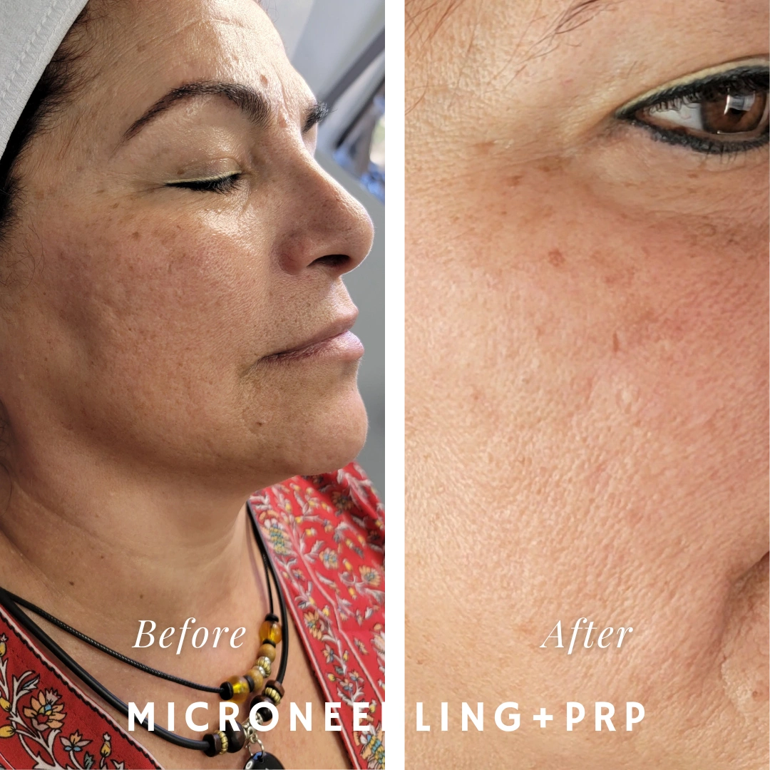 Antiaging Treatments