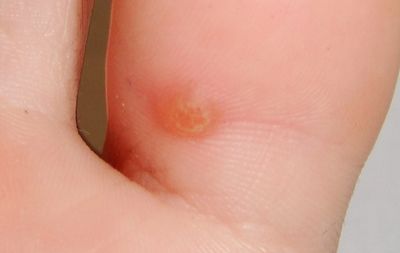 Dr Justin Lim Professor Yoland Lim Best Acupuncture Melbourne Skin Cosmetic Acupuncture Weight Loss 