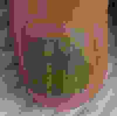 Fungal nail Treatment Dr JustinLim Dr SelinaLim Professor Yoland Lim Health Care Laser JUVEFACE skin