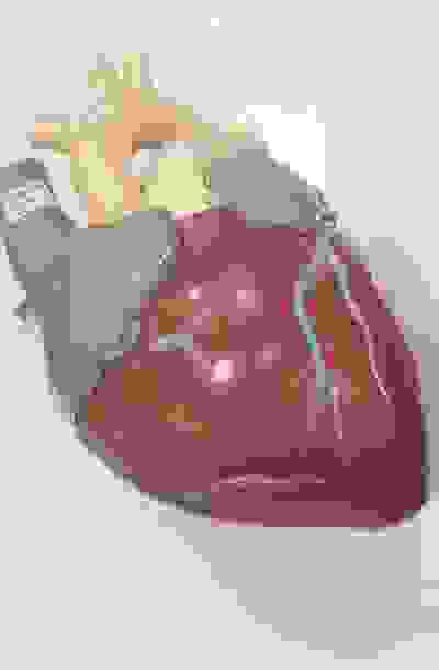 Heart AF Treatment Dr Justin Lim Dr Selina Lim Professor Yoland Lim Health Care Laser JUVEFACE skin