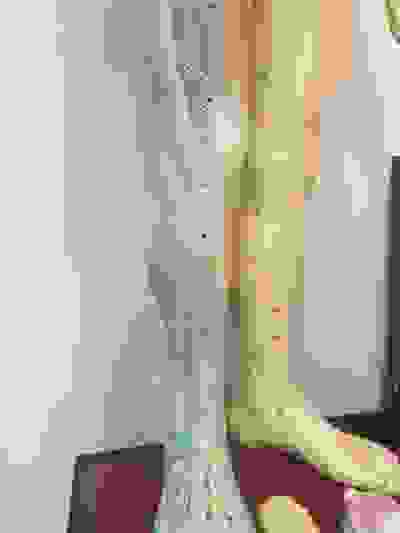 Treatment Dr Justin Lim Dr Selina Lim Professor Yoland Lim Health Care Laser JUVEFACE skin cramps