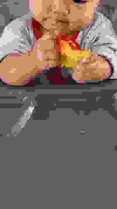 Acne Skin Treatment Dr Justin Lim Dr Selina Lim Professor Yoland Lim Health Care Laser JUVEFACE skin