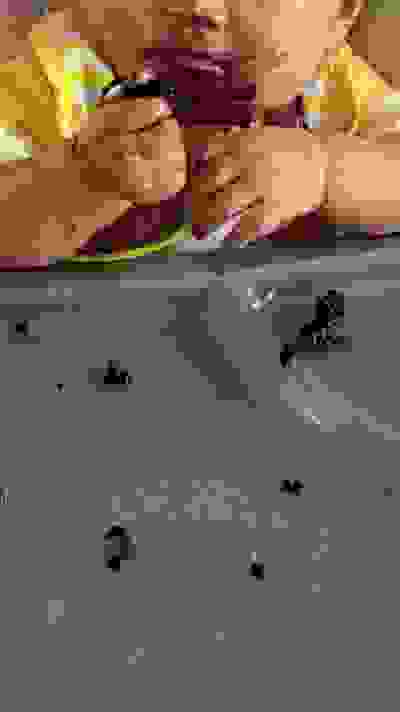 Acne Skin Treatment Dr Justin Lim Dr Selina Lim Professor Yoland Lim Health Care Laser JUVEFACE skin